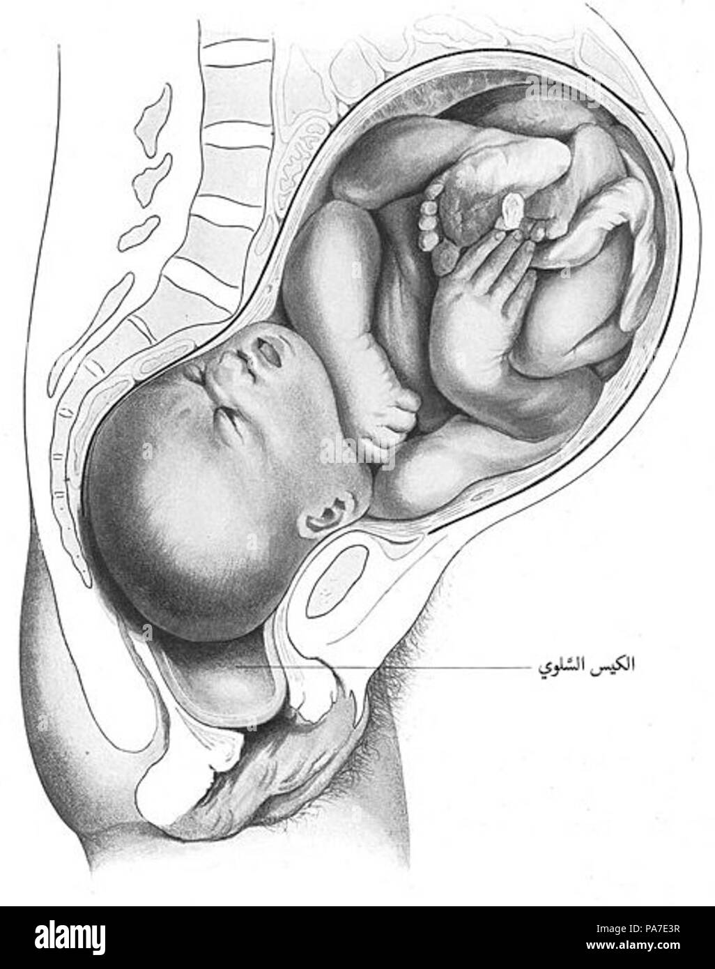 257 Bumm 158 lg-ar Foto Stock