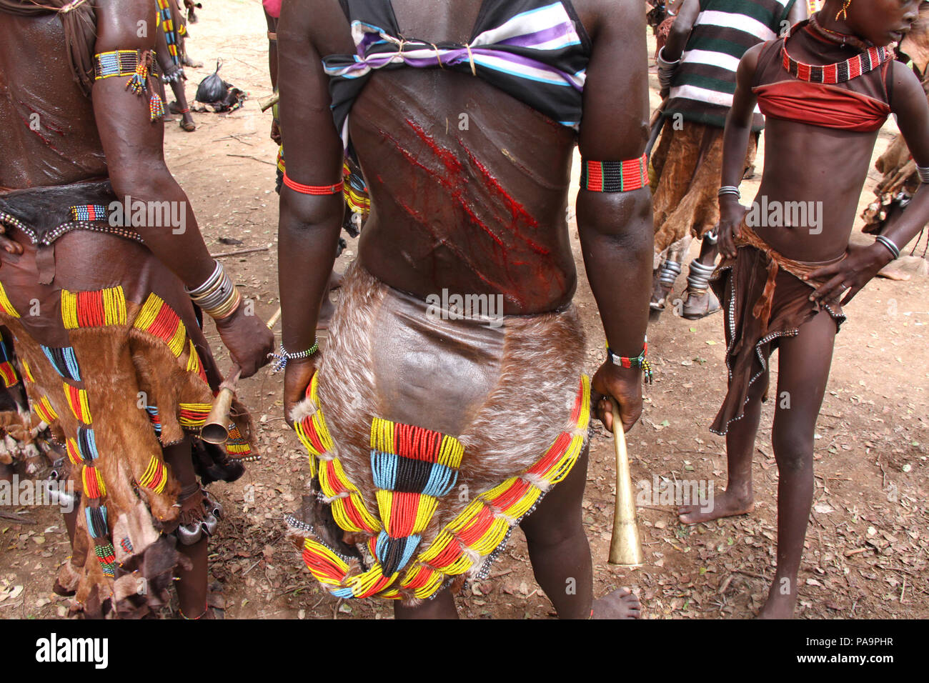 Ferite aperte da colpo di frusta durante Bull Jumping cerimonia (Ukuli rituale) da Hamer Hamar tribù, Etiopia Foto Stock
