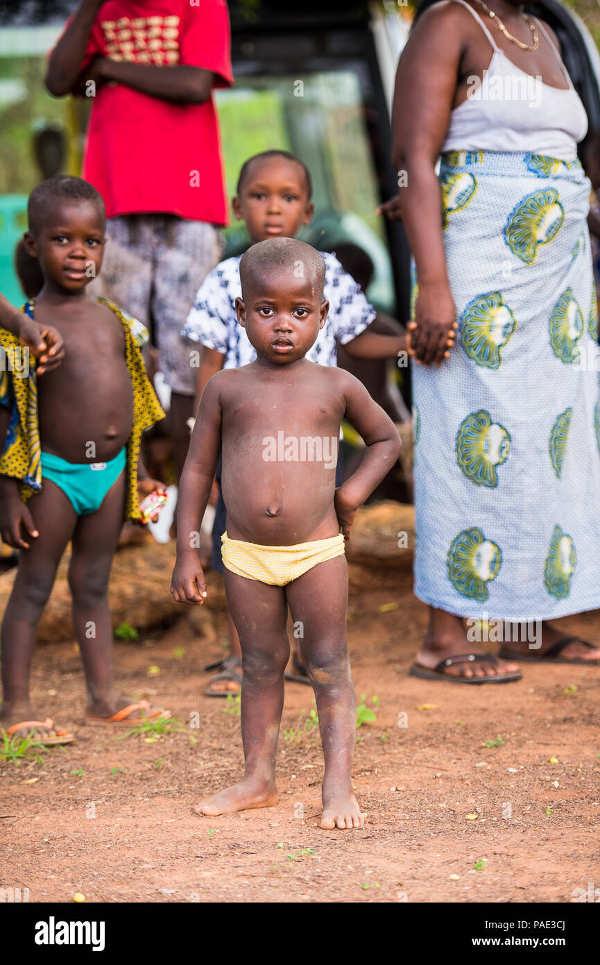 KARA, TOGO - Mar 9, 2013: Non identificato ragazzo togolese in mutande gialle soggiorni tra la folla. I bambini in Togo soffrono di povertà a causa della instabilità Foto Stock