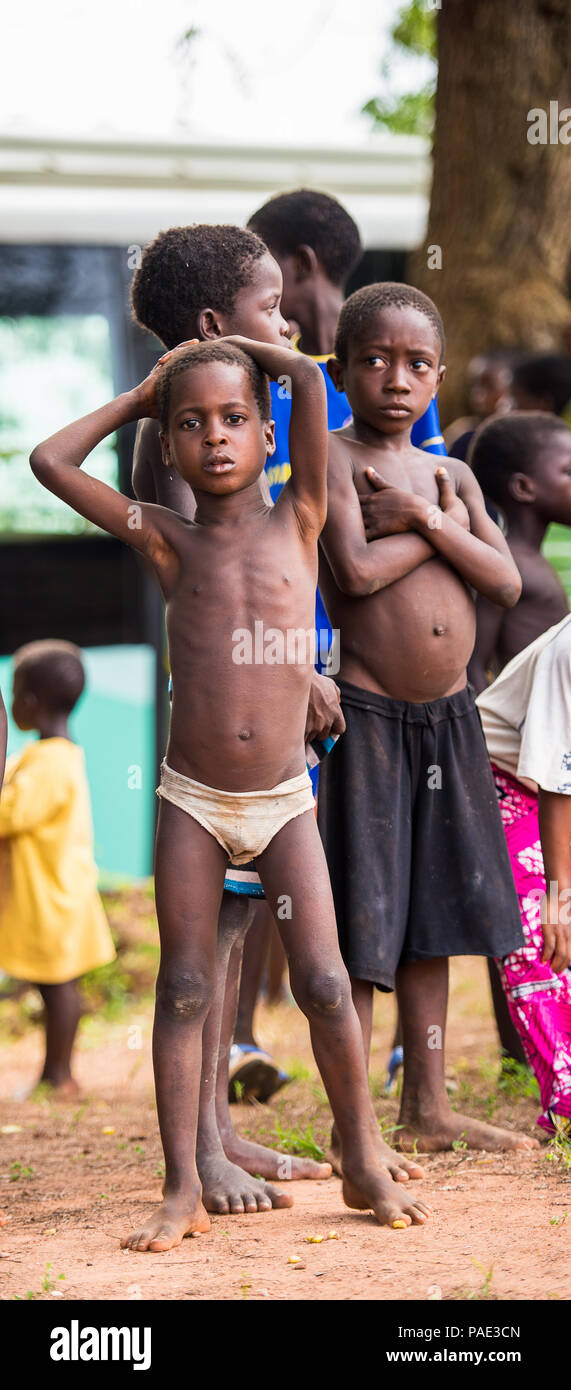 KARA, TOGO - Mar 9, 2013: Non identificato ragazzo togolese in mutande gialle soggiorni tra la folla. I bambini in Togo soffrono di povertà a causa della instabilità Foto Stock
