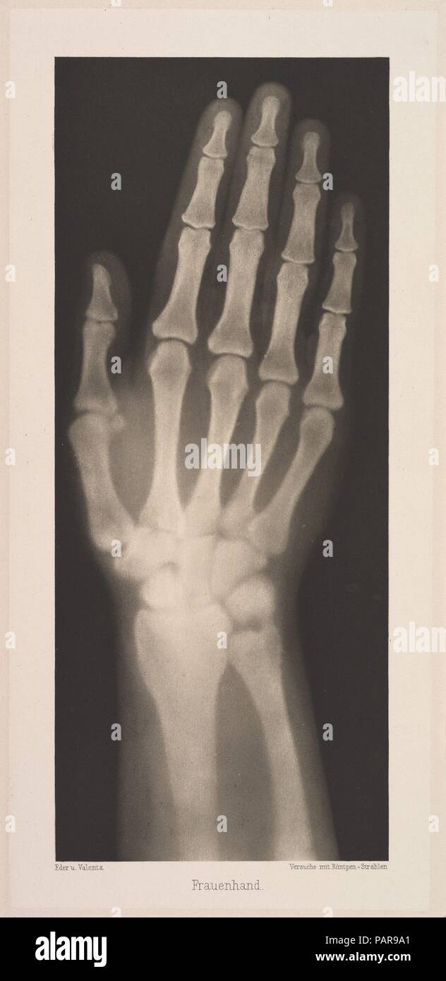 Frauenhand. Artista: Josef Maria Eder (austriaca di Krems an der Donau, 1855-1944 Kitzbühel); Eduard Valenta (Austriaco, 1857-1937). Dimensioni: Immagine: 10 3/16 x 4 1/4 in. (25,9 × 10,8 cm) Piastra: 11 7/16 x 5 5/16 in. (29 × 13,5 cm) foglio: 19 5/16 in. × 14 a. (49 × 35,5 cm). Data: 1896. Eder era il direttore dell' Istituto per i processi di grafica e autore di un inizio di storia della fotografia. Con il photochemist Valenta, ha prodotto un portafoglio nel gennaio 1896, a meno di un mese dopo la Wilhelm Conrad Röntgen pubblicò la sua scoperta dei raggi x. Eder e Valenta il volume dal quale questa piastra Foto Stock