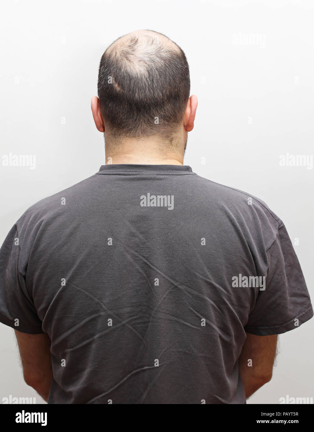 Vista posteriore della perdita dei capelli a mezza età uomo Foto Stock