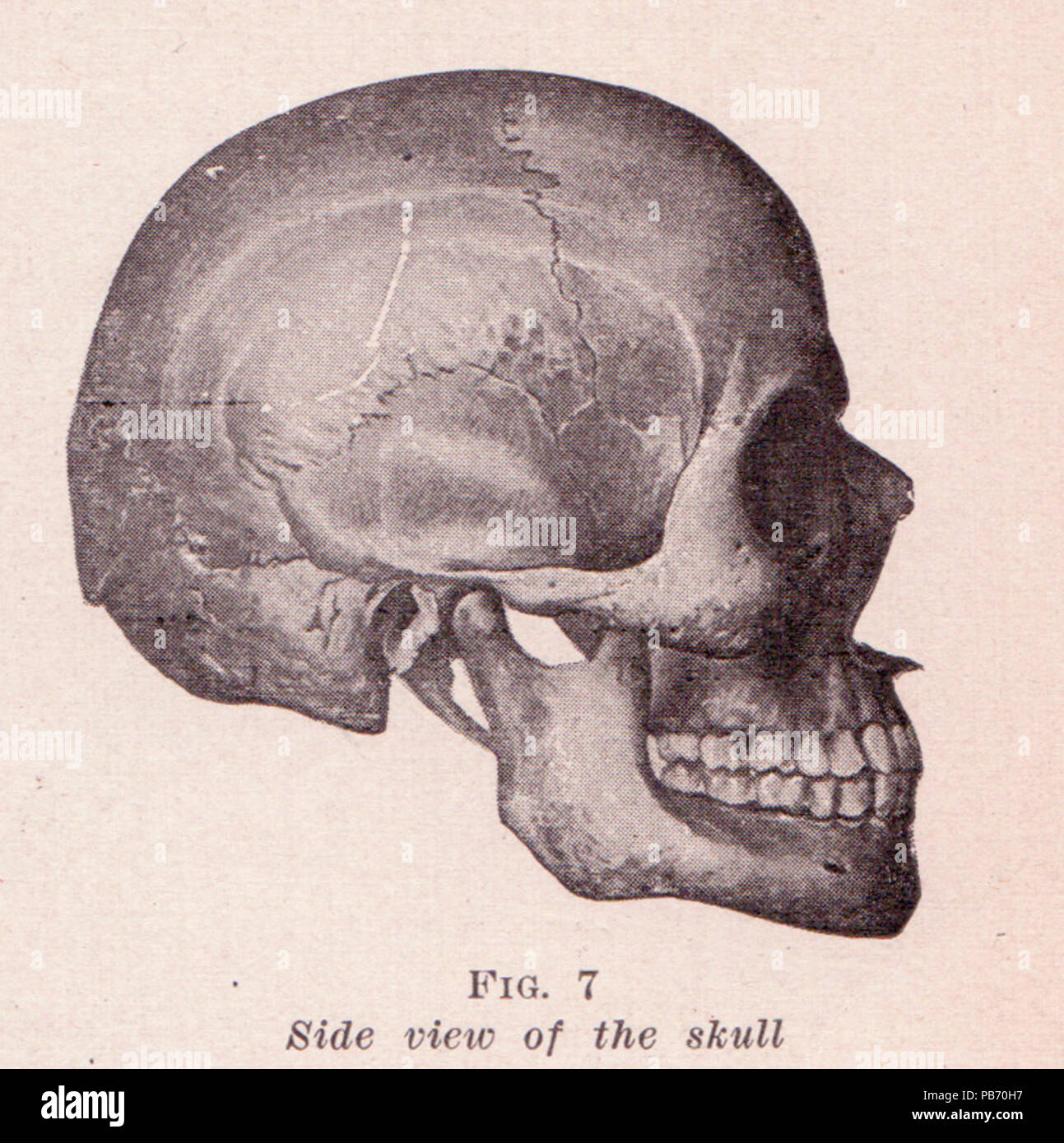 1544 cranio Vista laterale Foto Stock