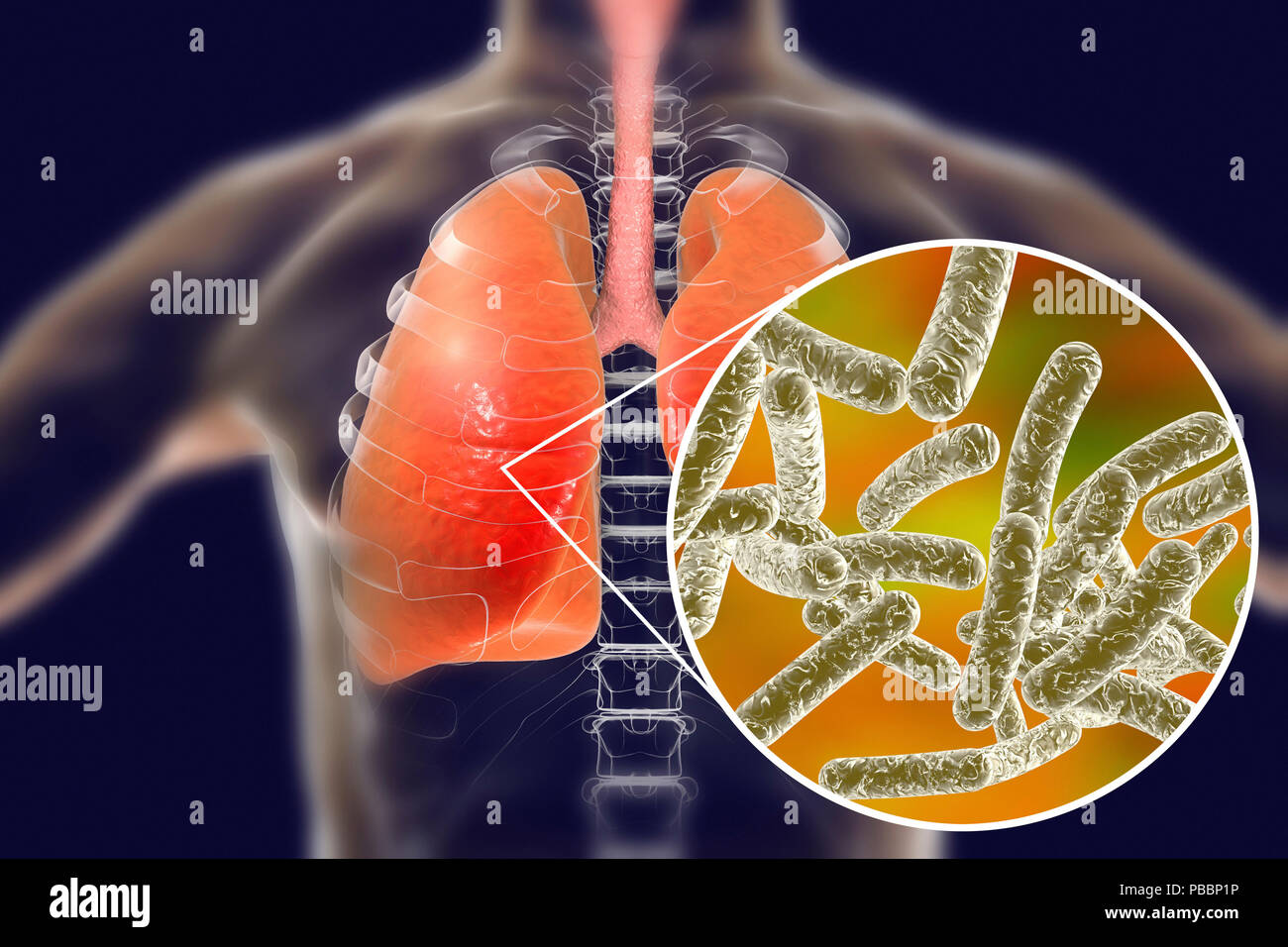 Le legionelle, concettuale illustrazione del computer. Legionella pneumophila i batteri sono la causa del morbo del legionario. Questi bacilli (a forma di asta batteri) sono Gram-negativi. L. pneumophila è stato identificato come un agente patogeno dopo una misteriosa epidemia di polmonite causato 29 morti in un American Legion convenzione nel 1976. Questo batterio è stato trovato che vivono in serbatoi di acqua, i bagni dispongono di doccia a telefono e sistemi di aria condizionata. La malattia provoca pneumonic irreversibili danni ai polmoni negli anziani e inadatti. Foto Stock