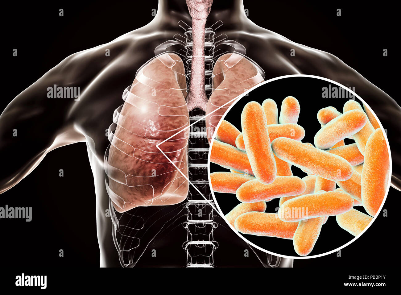 Le legionelle, concettuale illustrazione del computer. Legionella pneumophila i batteri sono la causa del morbo del legionario. Questi bacilli (a forma di asta batteri) sono Gram-negativi. L. pneumophila è stato identificato come un agente patogeno dopo una misteriosa epidemia di polmonite causato 29 morti in un American Legion convenzione nel 1976. Questo batterio è stato trovato che vivono in serbatoi di acqua, i bagni dispongono di doccia a telefono e sistemi di aria condizionata. La malattia provoca pneumonic irreversibili danni ai polmoni negli anziani e inadatti. Foto Stock