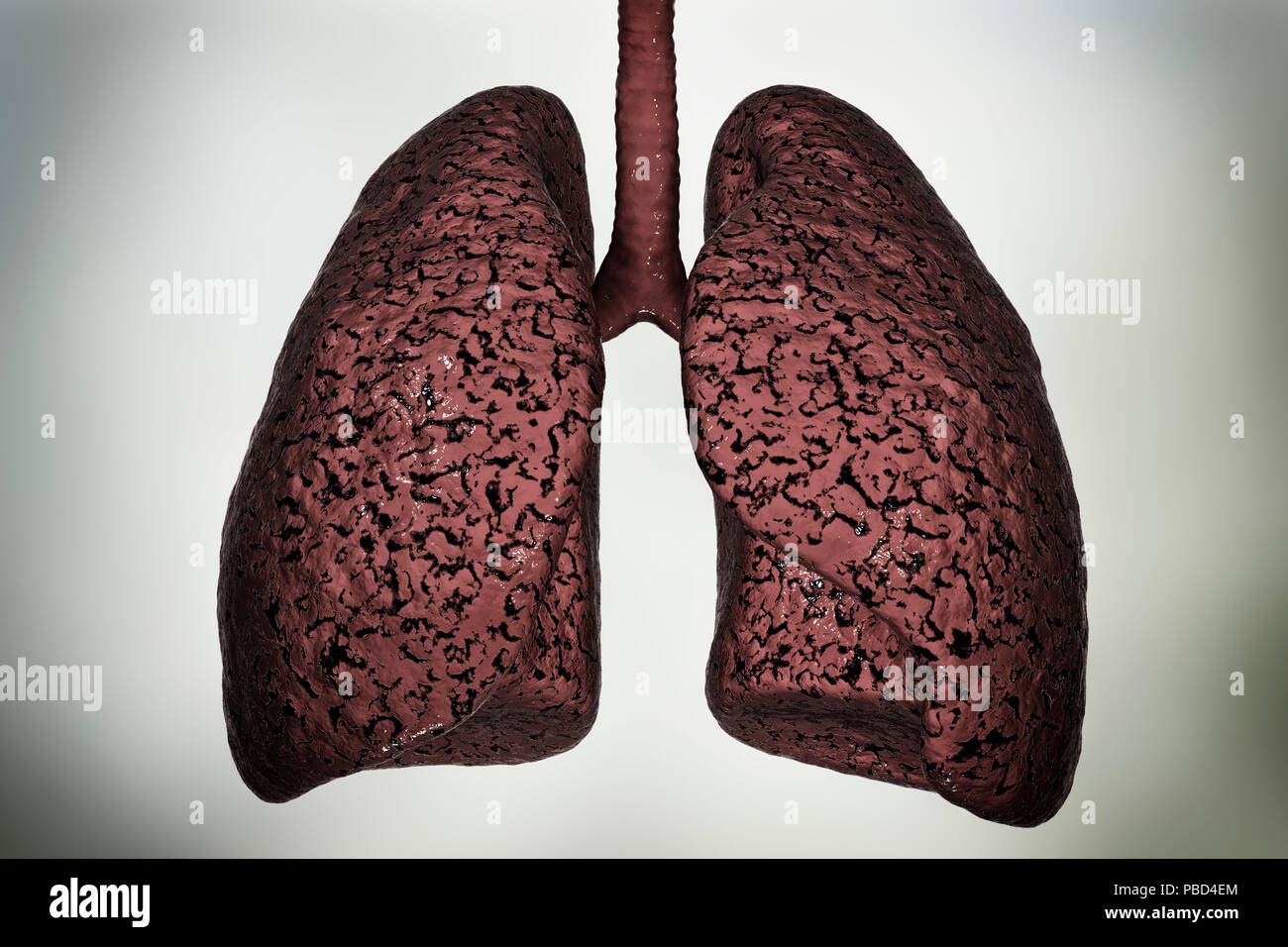 Polmoni dei fumatori immagini e fotografie stock ad alta risoluzione - Alamy