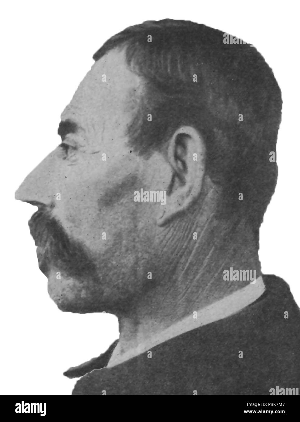 1909 "Torre-Skull" (padre di una persona con schizofrenia) Foto Stock