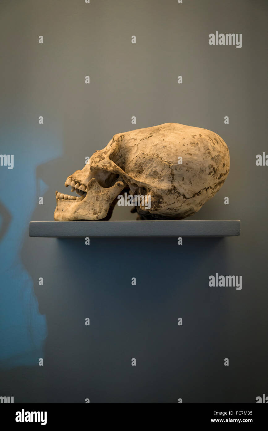 Distorto scull umano, il museo Amparo, Puebla, città in Est-Messico centrale Foto Stock