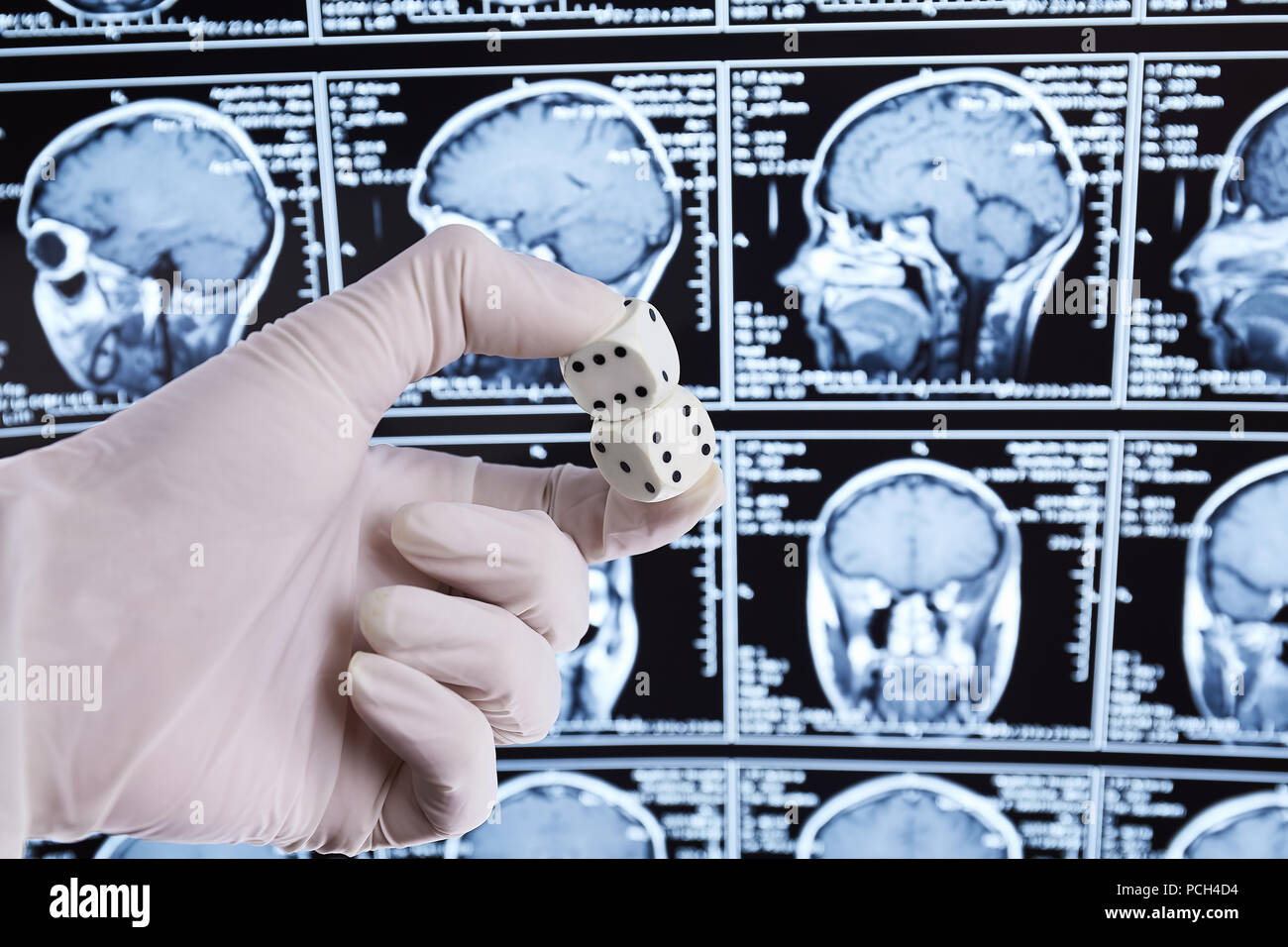 La risonanza magnetica la scansione del cervello. MRI. Dadi in mano. Foto Stock