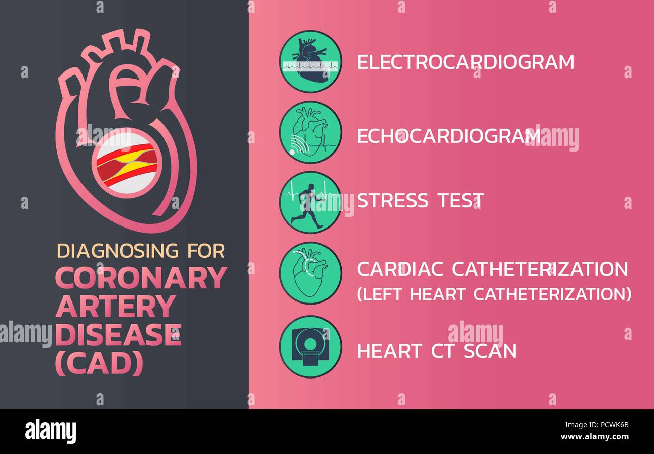 La diagnosi di una malattia delle arterie coronarie (CAD) icona design, una infografica salute medica ed infografico. Illustrazione Vettoriale Illustrazione Vettoriale