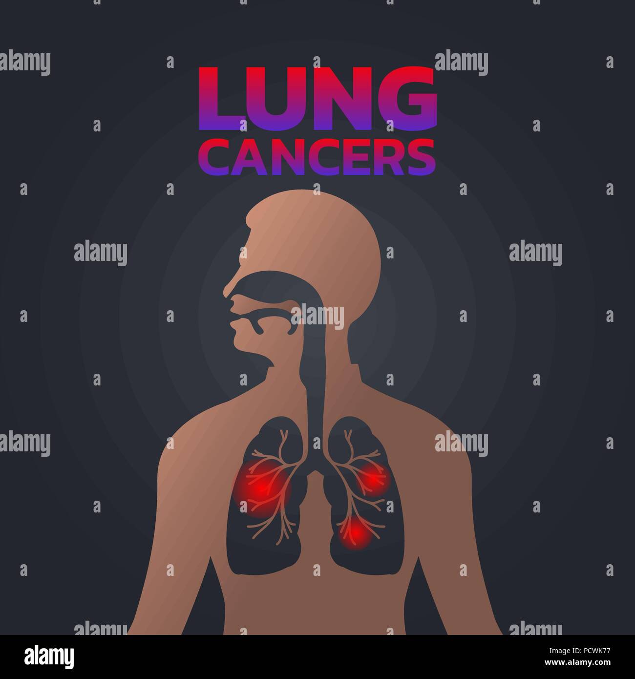 Cancri del polmone icona design, una infografica salute medica ed infografico. Illustrazione Vettoriale Illustrazione Vettoriale