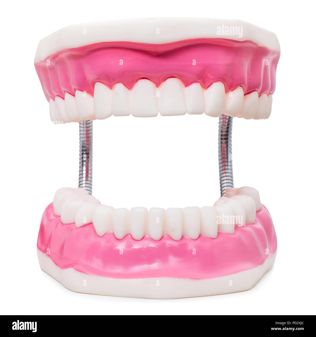 Macro close up ancora in vita di sovradimensionare denti umani protesi isolati su sfondo bianco. Foto Stock