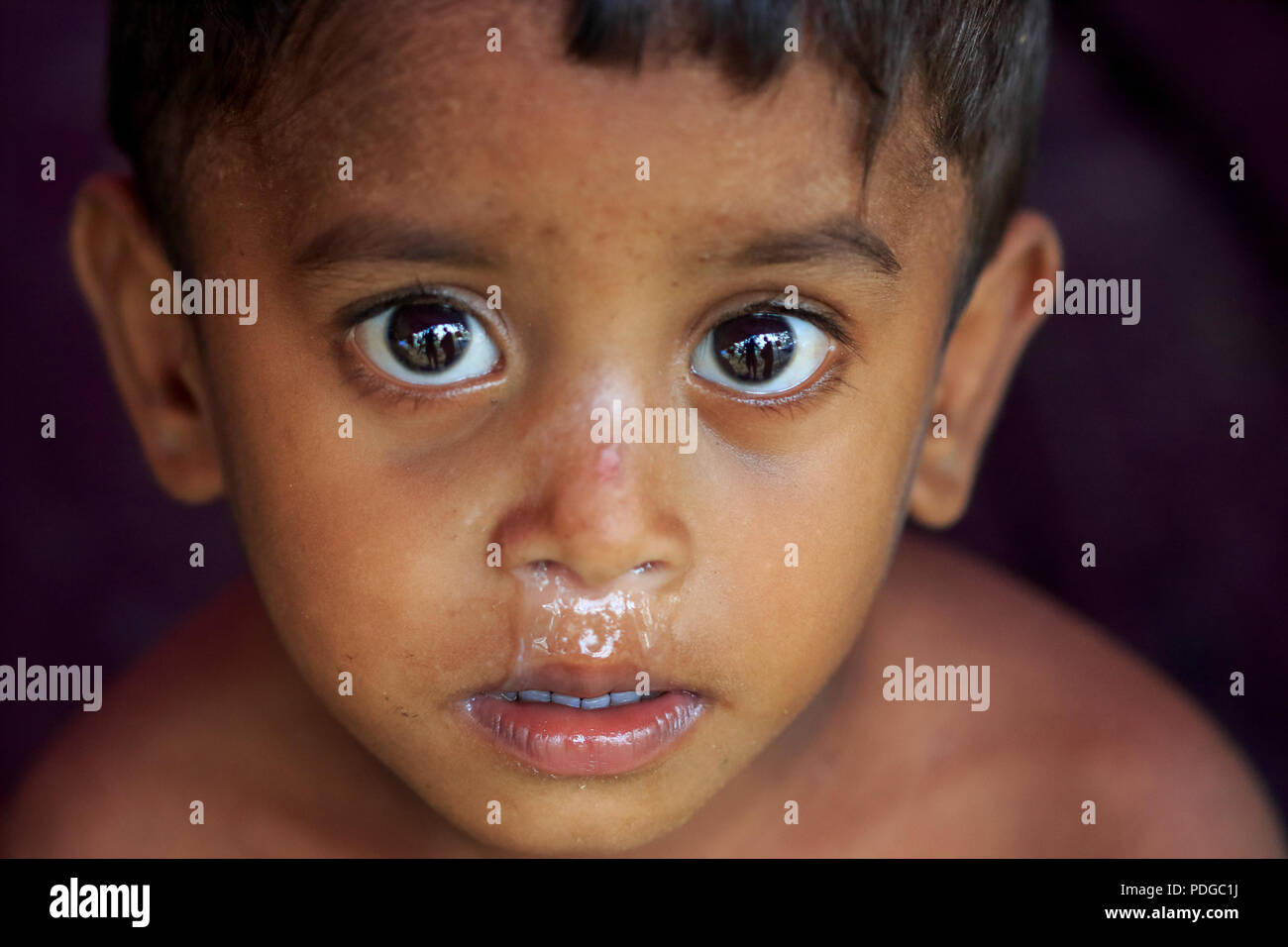 Un rifugiato Rohingya boy a Balukhali Refugee Camp. Cox's Bazar, Bangladesh Foto Stock