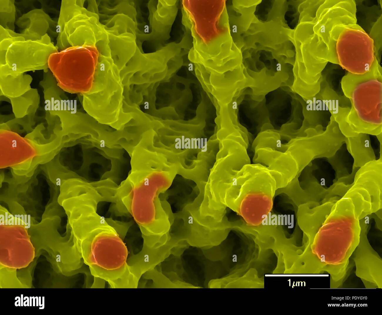 Microstrutture su nichel. Color scanning electron microfotografia (SEM) di microstrutture formate su una superficie di nichel mediante un fascio laser. Questa ricerca comporta l'uso di laser per etch e ablare il metallo e superfici di semiconduttore. La risultante delle microstrutture e nanostrutture può avere applicazioni in varie forme di elettronica e la nanotecnologia. Foto Stock