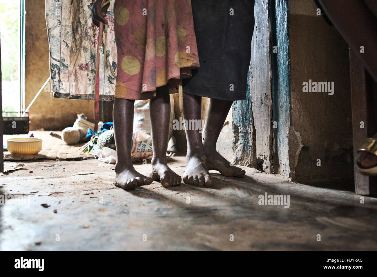 Due giovani scalzi bambini ugandesi stand nella loro casa di famiglia nel sud-ovest dell Uganda che mostra i loro piedi nudi e povertà Foto Stock