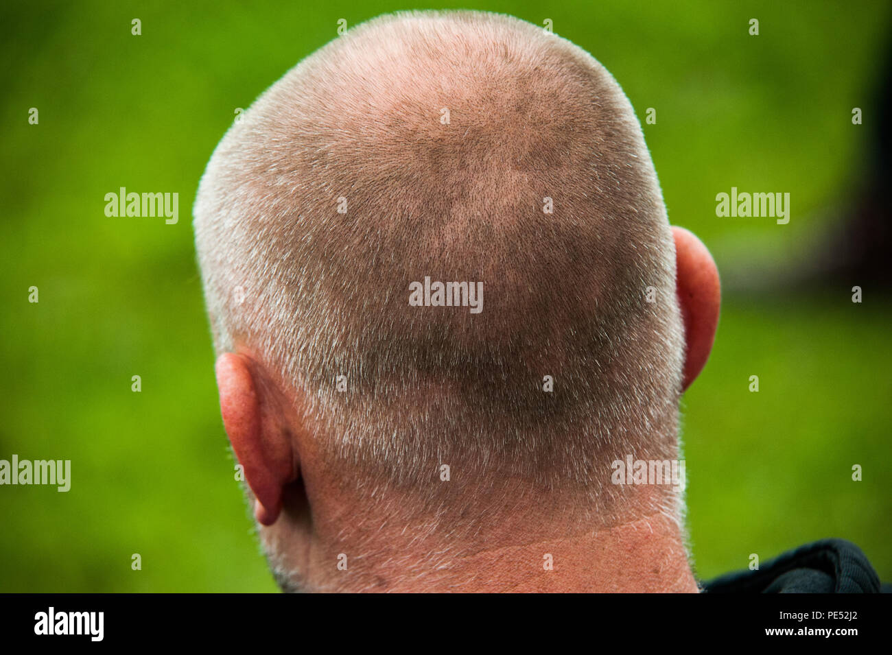 L'uomo calvo testa Foto Stock