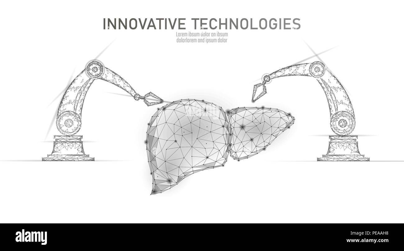 Robotica chirurgia del fegato basso poli. Epatite poligonale procedura chirurgica. Il braccio di robot manipolatore. Moderna medicina innovativa scienza tecnologia di automazione. Triangolo 3D render forma illustrazione vettoriale Illustrazione Vettoriale