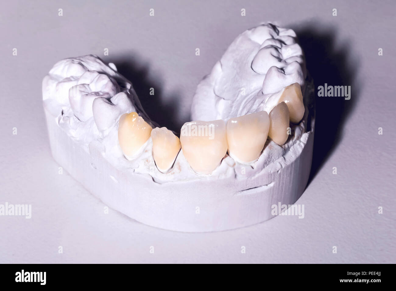 Foto di dental modelli in gesso sul tavolo Foto Stock