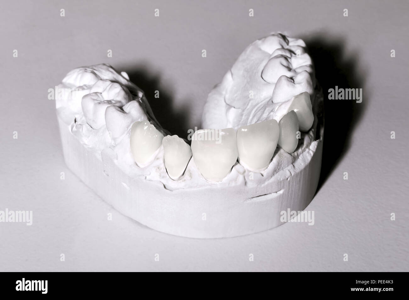 Foto di dental modelli in gesso sul tavolo Foto Stock