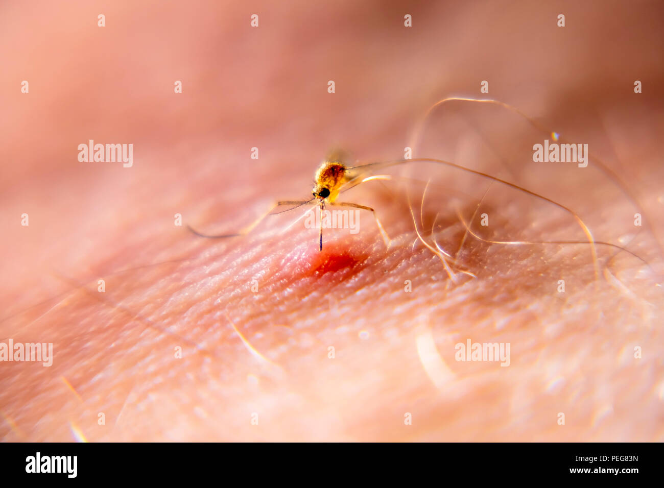 Close-up di zanzara succhiare il sangue dalla pelle umana. Foto Stock