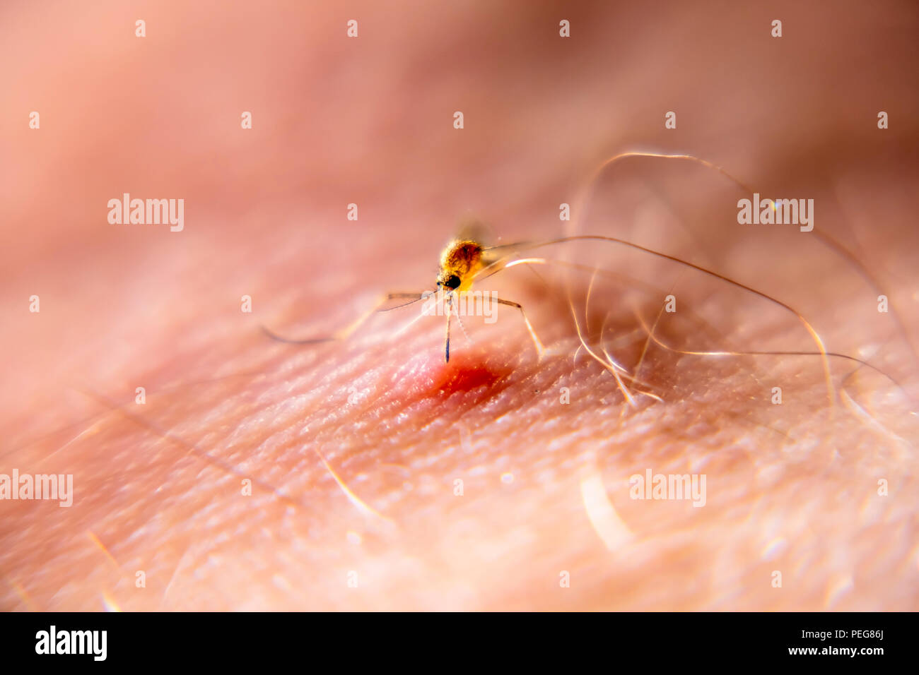 Close-up di zanzara succhiare il sangue dalla pelle umana. Foto Stock