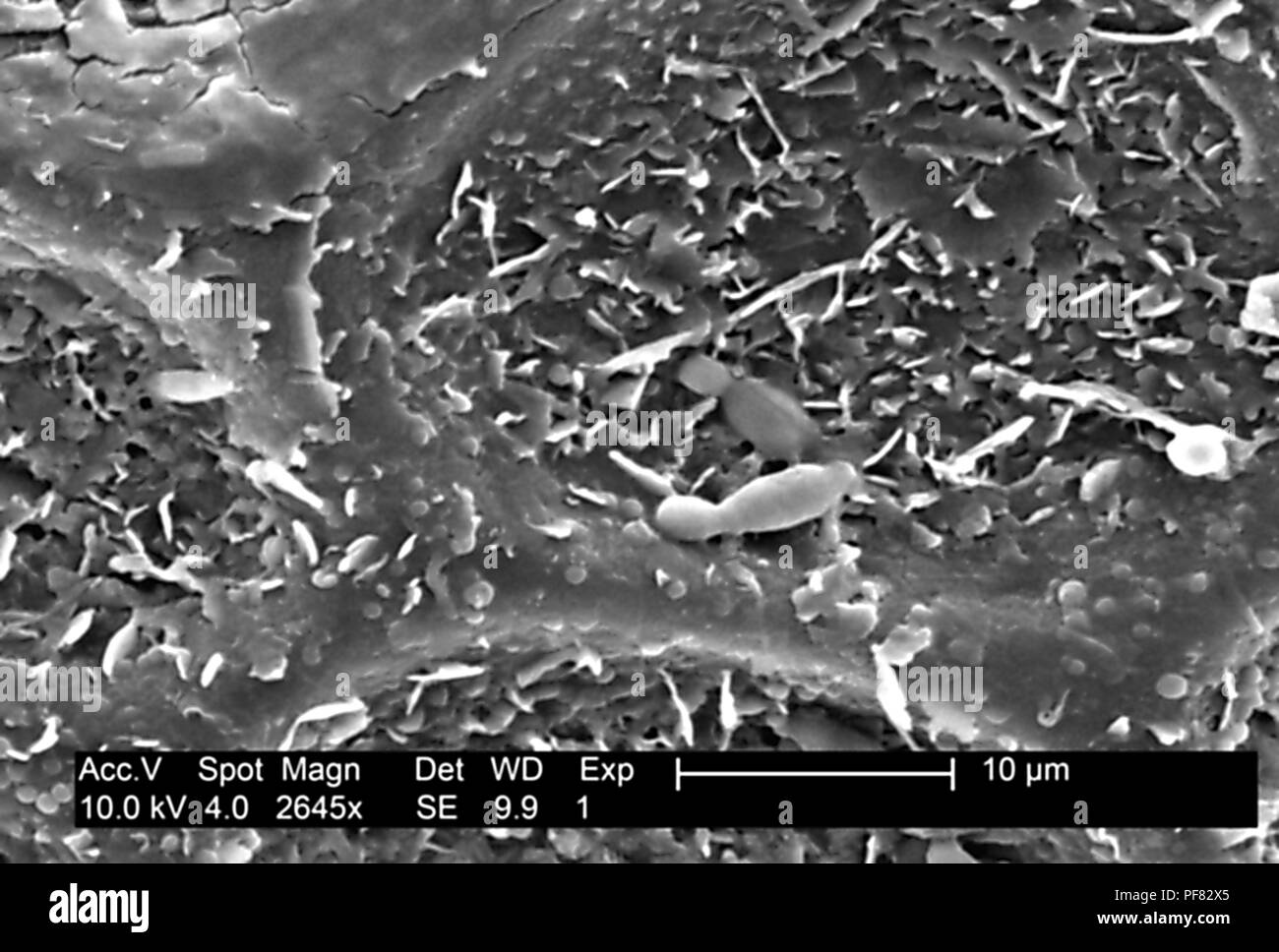Superficie testurizzata dettagli trovati su un melone Honeydew (Cucumis melo), ha rivelato nel 2645x ingrandito electron microfotografia film, 2004. Immagine cortesia di centri per il controllo delle malattie (CDC). () Foto Stock