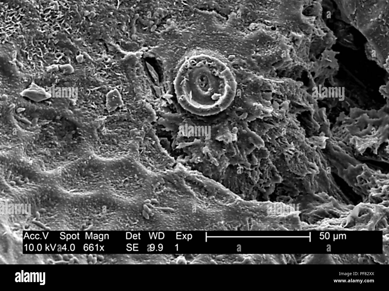 Superficie testurizzata dettagli trovati su un melone Honeydew (Cucumis melo), ha rivelato nel 661x ingrandito electron microfotografia film, 2004. Immagine cortesia di centri per il controllo delle malattie (CDC). () Foto Stock