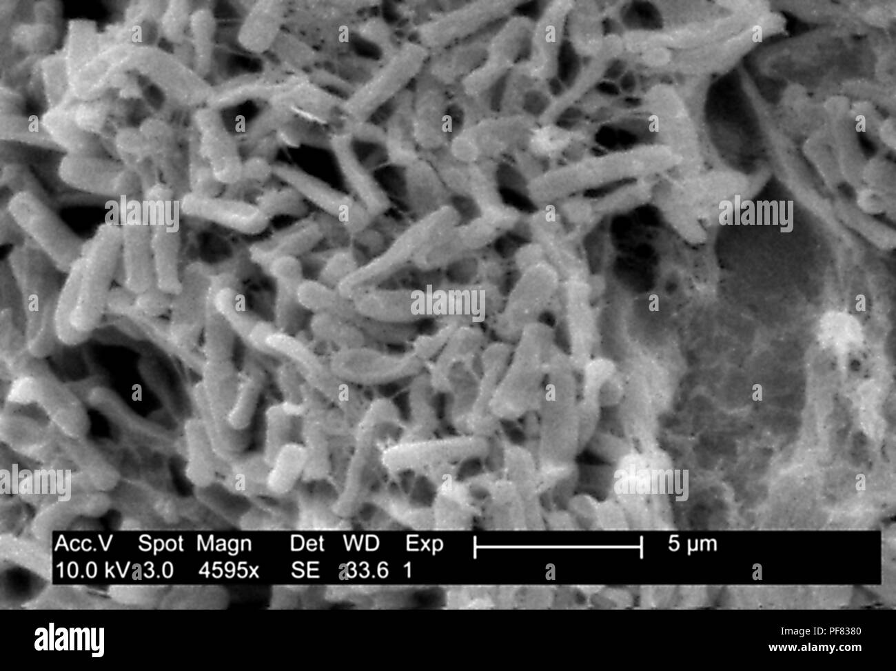 Gram-positivo Clostridium difficile batteri hanno rivelato nel campione di feci microfotografia film, 2004. Immagine cortesia di centri per il controllo delle malattie (CDC) / Lois S. Wiggs. () Foto Stock