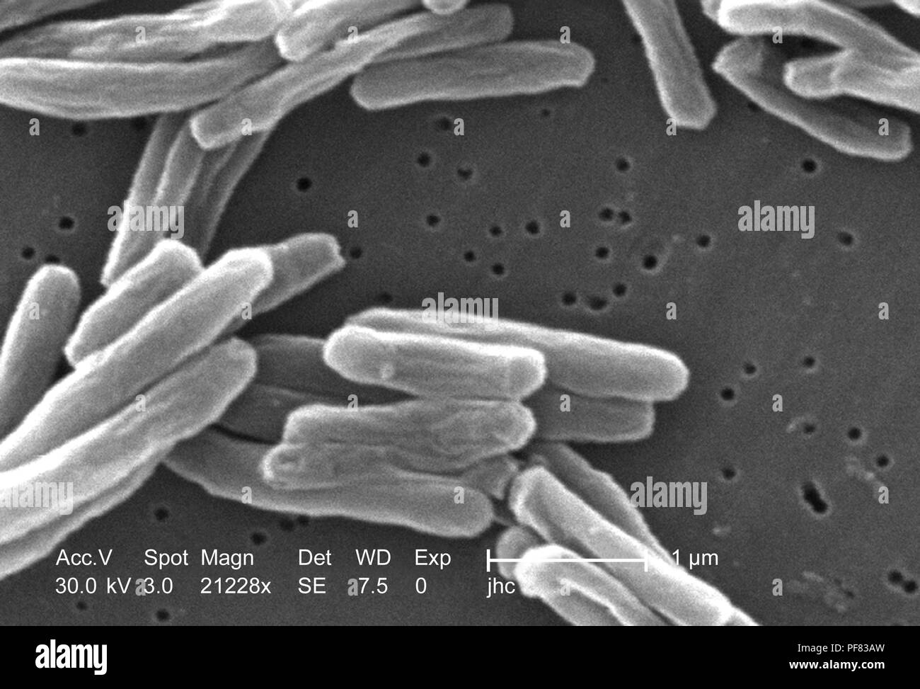 Dettagli ultrastrutturali di Gram-positivi di Mycobacterium tuberculosis batteri hanno rivelato nel 21228x scansione ingrandita al microscopio elettronico (SEM) immagine, 2006. Immagine cortesia di centri per il controllo delle malattie (CDC) / Ray Butler, MS, Janice Haney Carr. () Foto Stock