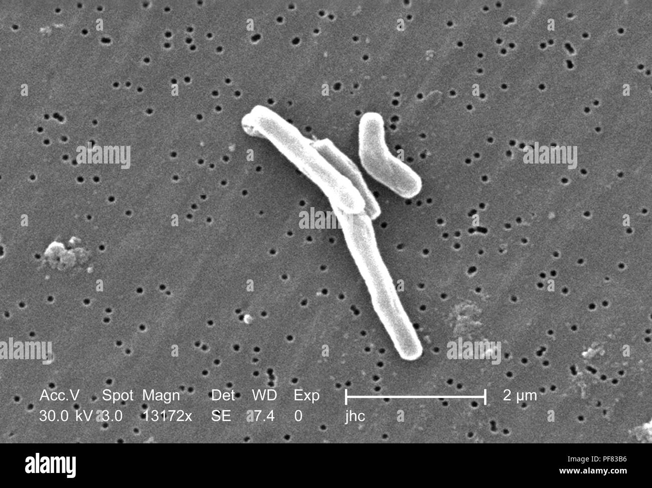 Gram-positivi di Mycobacterium tuberculosis batteri hanno rivelato nel 13172x scansione ingrandita al microscopio elettronico (SEM) immagine, 2006. Immagine cortesia di centri per il controllo delle malattie (CDC) / Ray Butler, MS, Janice Haney Carr. () Foto Stock