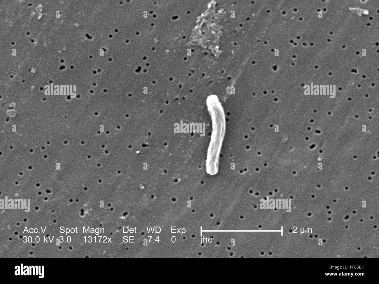 Unico Gram-positivi di Mycobacterium tuberculosis batterio ha rivelato nel 13172x scansione ingrandita al microscopio elettronico (SEM) immagine, 2006. Immagine cortesia di centri per il controllo delle malattie (CDC) / Ray Butler, MS, Janice Haney Carr. () Foto Stock