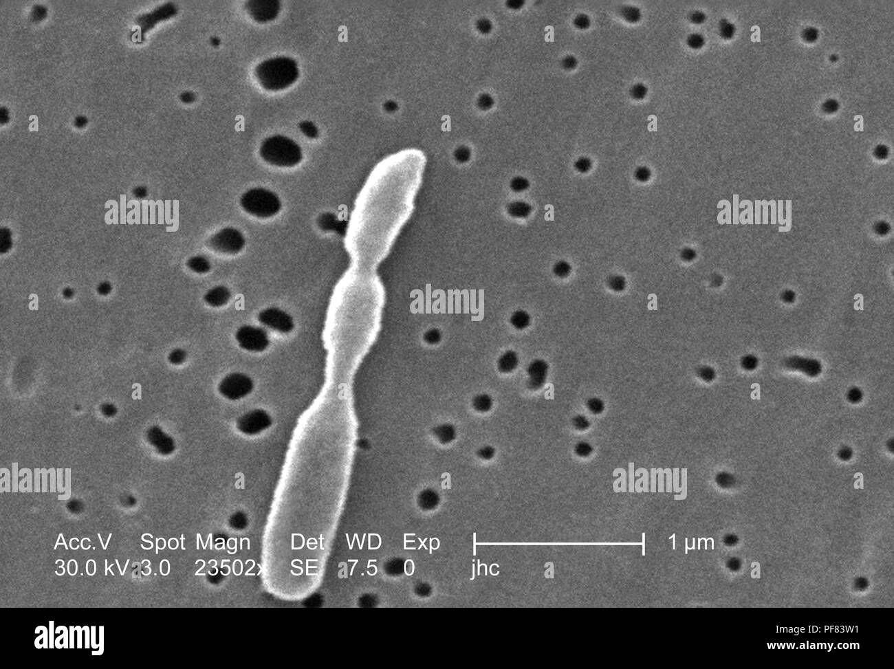 Fortemente ingrandita di un Ralstonia mannitolilytica batterio ha rivelato nel 23502x scansione ingrandita al microscopio elettronico (SEM) immagine, 2006. Immagine cortesia di centri per il controllo delle malattie (CDC) / Judith Noble-Wang, Ph.D. () Foto Stock