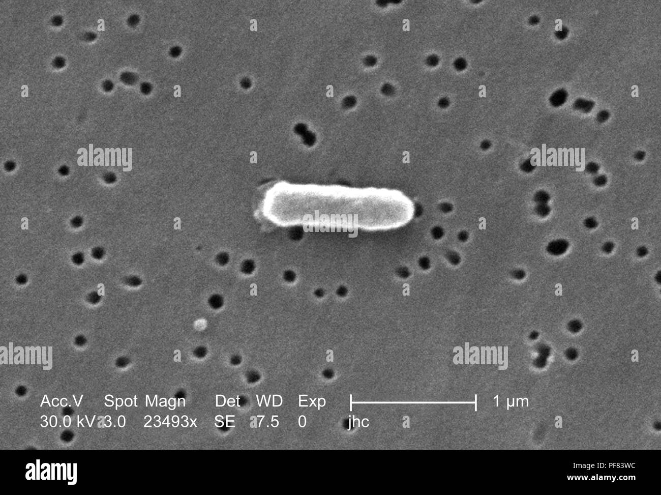 Fortemente ingrandita di un Ralstonia mannitolilytica batterio ha rivelato nel 23493x scansione ingrandita al microscopio elettronico (SEM) immagine, 2006. Immagine cortesia di centri per il controllo delle malattie (CDC) / Judith Noble-Wang, Ph.D. () Foto Stock