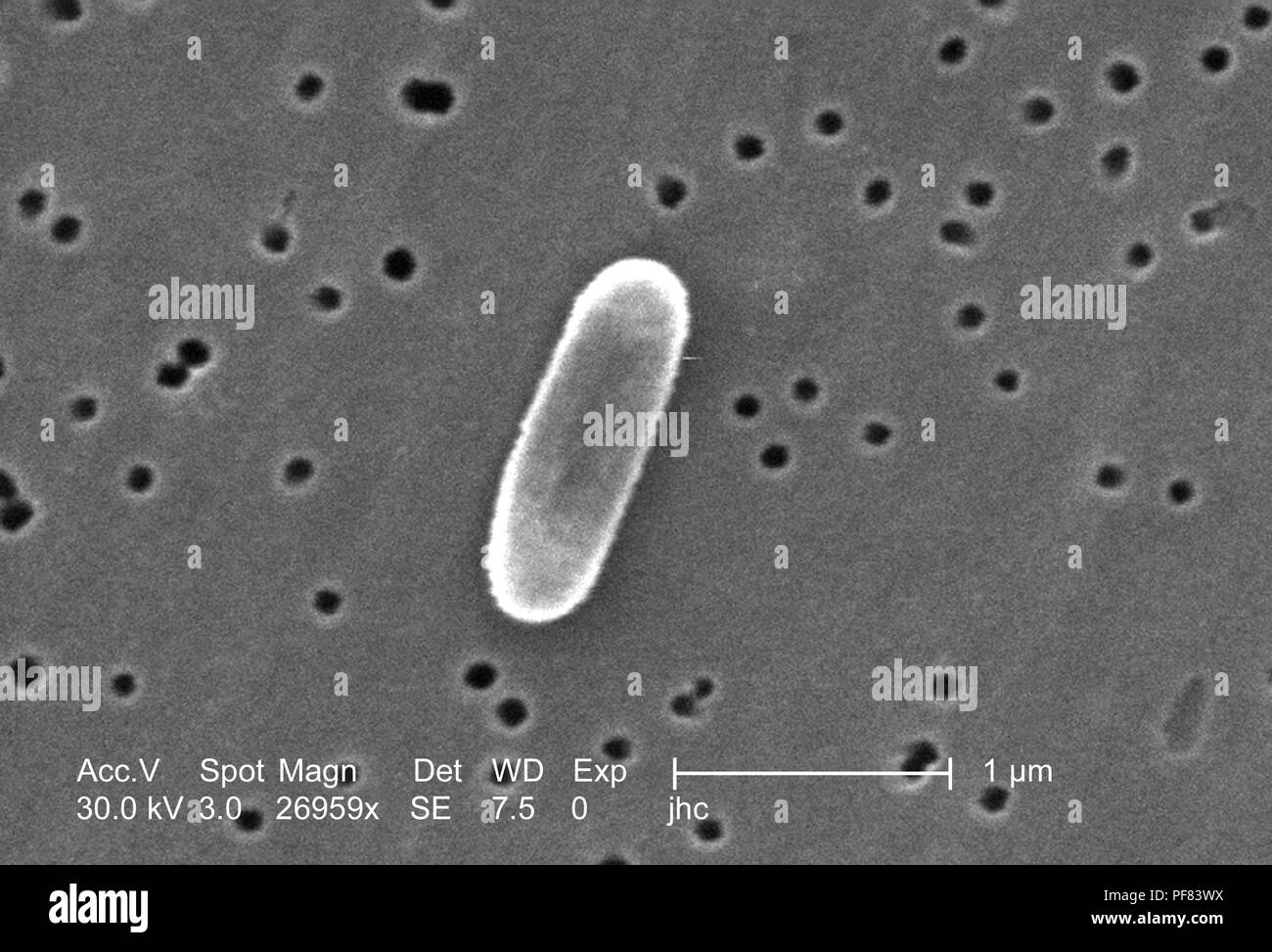 Fortemente ingrandita di un Ralstonia mannitolilytica batterio ha rivelato nel 26959x scansione ingrandita al microscopio elettronico (SEM) immagine, 2006. Immagine cortesia di centri per il controllo delle malattie (CDC) / Judith Noble-Wang, Ph.D. () Foto Stock