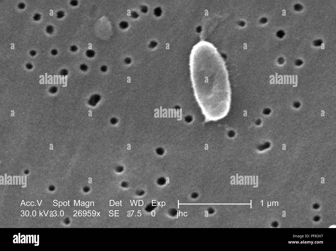 Fortemente ingrandita di un Ralstonia mannitolilytica batterio ha rivelato nel 26959x scansione ingrandita al microscopio elettronico (SEM) immagine, 2006. Immagine cortesia di centri per il controllo delle malattie (CDC) / Judith Noble-Wang, Ph.D. () Foto Stock