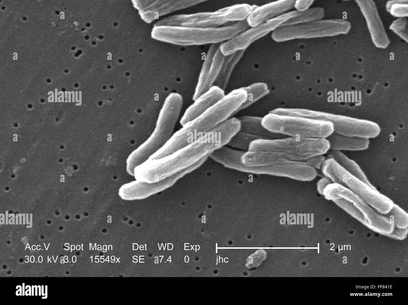 Dettagli ultrastrutturali di Gram-positivi di Mycobacterium tuberculosis batteri hanno rivelato nel 15549x scansione ingrandita al microscopio elettronico (SEM) immagine, 2006. Immagine cortesia di centri per il controllo delle malattie (CDC) / Ray Butler, MS, Janice Haney Carr. () Foto Stock