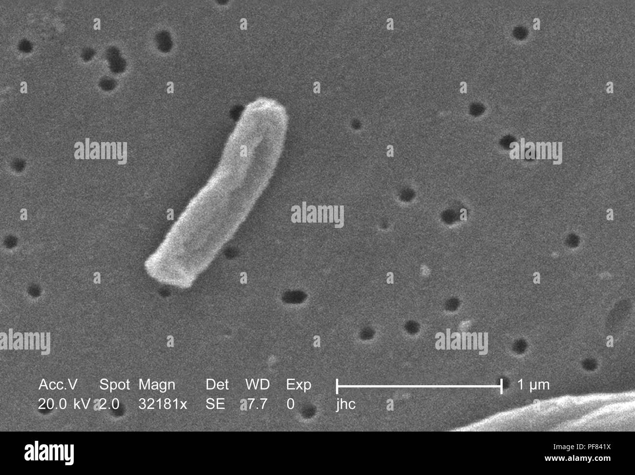 Dettagli ultrastrutturali di Gram-positivi di Mycobacterium tuberculosis batteri hanno rivelato nel 32181x scansione ingrandita al microscopio elettronico (SEM) immagine, 2006. Immagine cortesia di centri per il controllo delle malattie (CDC) / Ray Butler, MS, Janice Haney Carr. () Foto Stock
