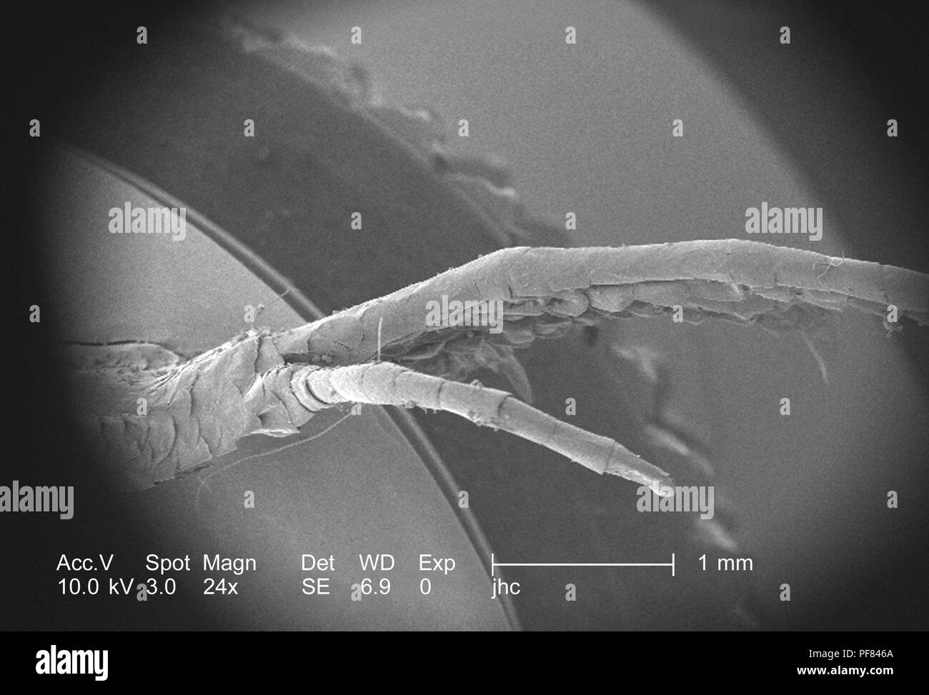 Caratteristiche morfologiche di un defunto lizard piede trovati in Decatur, Georgia, ha rivelato nel 24x di scansione ingrandita al microscopio elettronico (SEM) immagine, 2006. Immagine cortesia di centri per il controllo delle malattie (CDC) / William L. Nicholson, Ph.D. Cal Welbourn, Ph.D. Gary R. Mullen. () Foto Stock