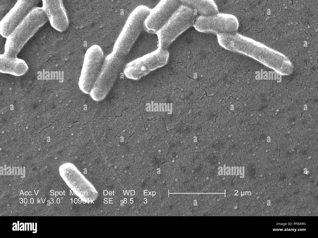 Gram-negativi Batteri Escherichia coli del ceppo O157:H7, ha rivelato nel 10961x scansione ingrandita al microscopio elettronico (SEM) immagine, 2006. Immagine cortesia di centri per il controllo delle malattie (CDC) / Nazionale Escherichia, Shigella, Vibrio unità di riferimento presso la CDC. () Foto Stock