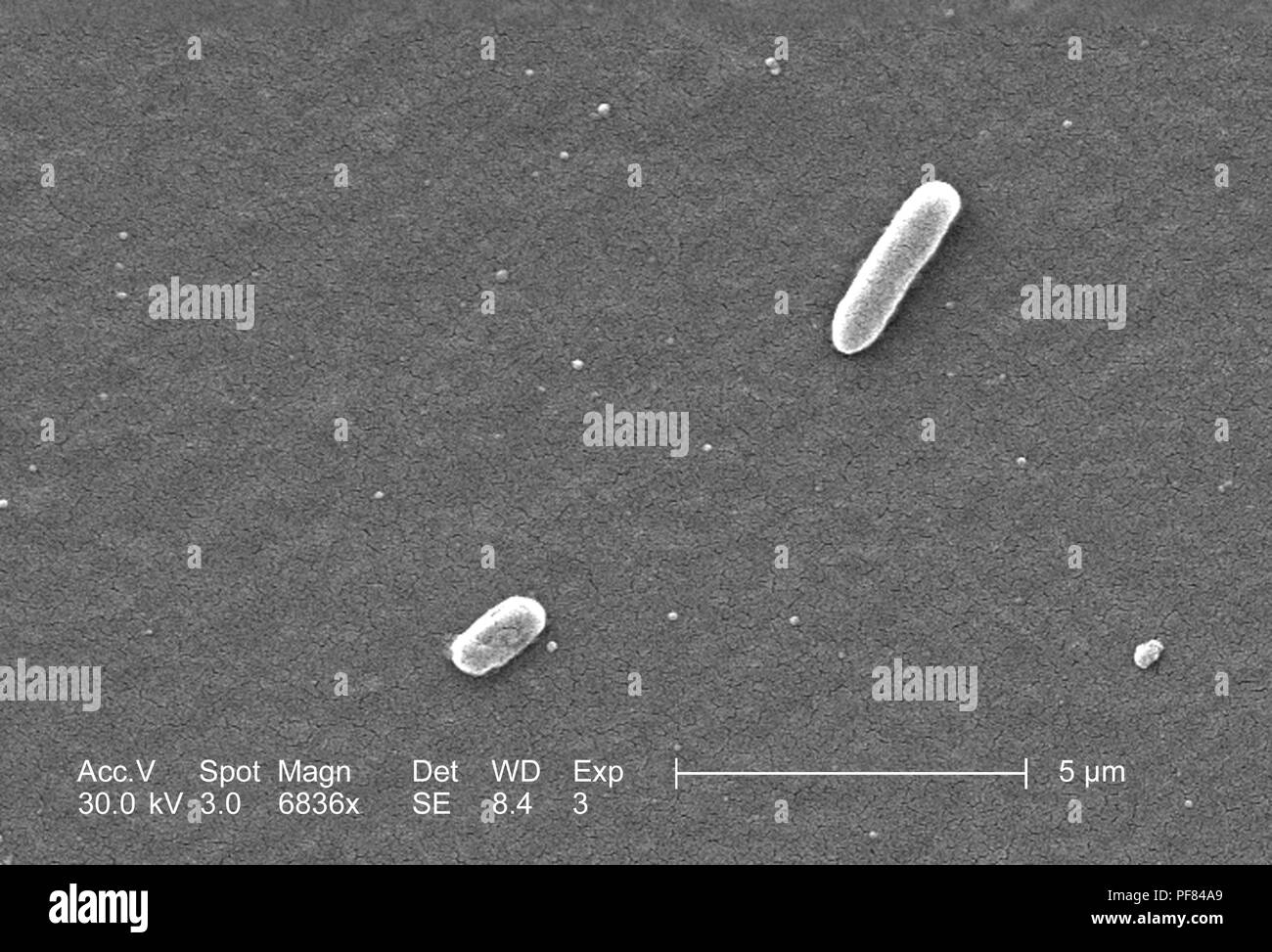 Gram-negativi Batteri Escherichia coli del ceppo O157:H7, ha rivelato nel 6836x di scansione ingrandita al microscopio elettronico (SEM) immagine, 2006. Immagine cortesia di centri per il controllo delle malattie (CDC) / Nazionale Escherichia, Shigella, Vibrio unità di riferimento presso la CDC. () Foto Stock