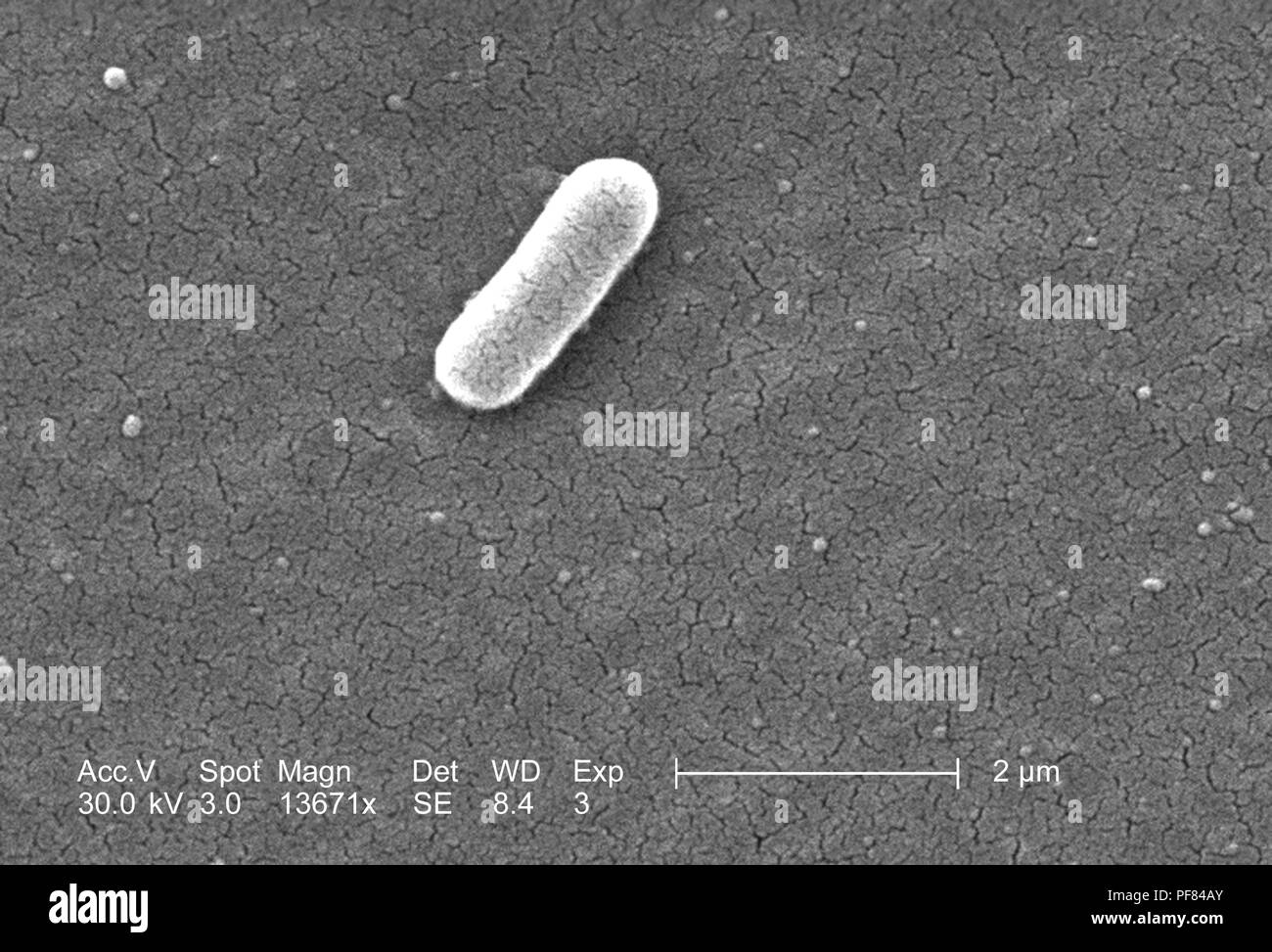 Gram-negativi Batteri Escherichia coli del ceppo O157:H7, ha rivelato nel 13671x scansione ingrandita al microscopio elettronico (SEM) immagine, 2006. Immagine cortesia di centri per il controllo delle malattie (CDC) / Nazionale Escherichia, Shigella, Vibrio unità di riferimento presso la CDC. () Foto Stock