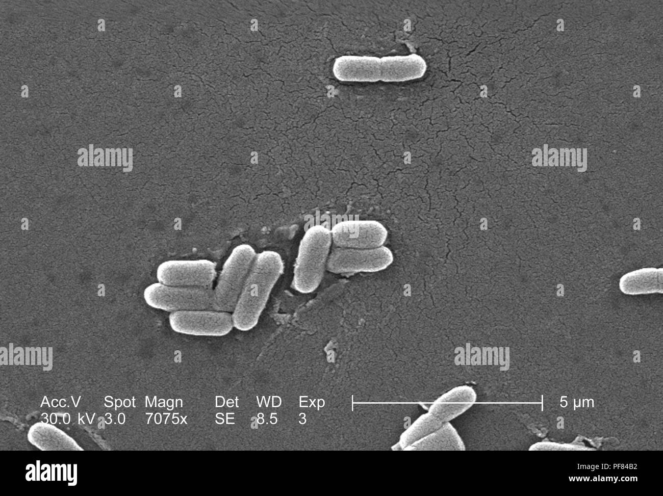 Gram-negativi Batteri Escherichia coli del ceppo O157:H7, ha rivelato nel 7075x di scansione ingrandita al microscopio elettronico (SEM) immagine, 2006. Immagine cortesia di centri per il controllo delle malattie (CDC) / Nazionale Escherichia, Shigella, Vibrio unità di riferimento presso la CDC. () Foto Stock