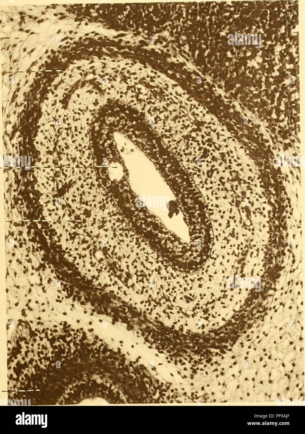 . Deutsche Südpolar-Expedition, 1901-1903, im Auftrage des Reichsamtes des Innern. Gauss (nave); spedizioni scientifiche; Antartide. Ü: TSCHE SüDPOLAR-spedizione. 1901-3. Band XIV Tafel UV. esench.- --. Fig. 26. Musc.--?j^:s ijbmuc. - Muc. r. Si prega di notare che queste immagini vengono estratte dalla pagina sottoposta a scansione di immagini che possono essere state migliorate digitalmente per la leggibilità - Colorazione e aspetto di queste illustrazioni potrebbero non perfettamente assomigliano al lavoro originale. Deutsche Südpolar-Expedition (1901-1903); Drygalski, Erich von, 1865-1949. Berlino, G. Reimer Foto Stock