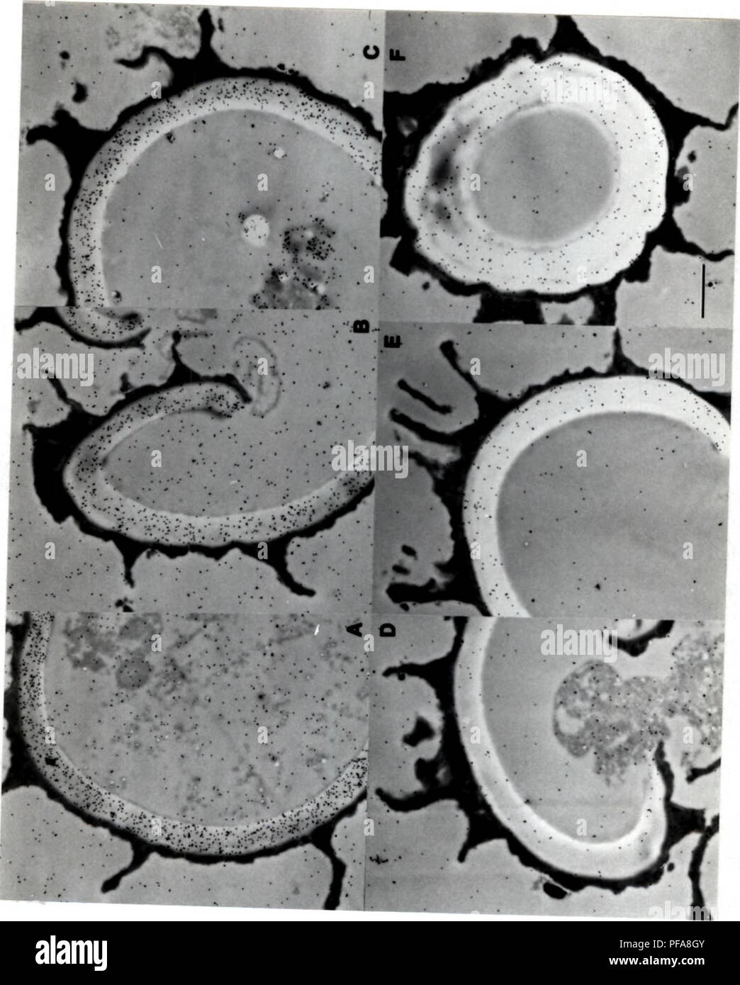 . Sviluppo di metodi cytochemical per lo studio della parete ascospore biogenesis e maturazione. Ascomycetes; delle ascospore; funghi. 113. Si prega di notare che queste immagini vengono estratte dalla pagina sottoposta a scansione di immagini che possono essere state migliorate digitalmente per la leggibilità - Colorazione e aspetto di queste illustrazioni potrebbero non perfettamente assomigliano al lavoro originale. Lusk, Demaris E.. Foto Stock