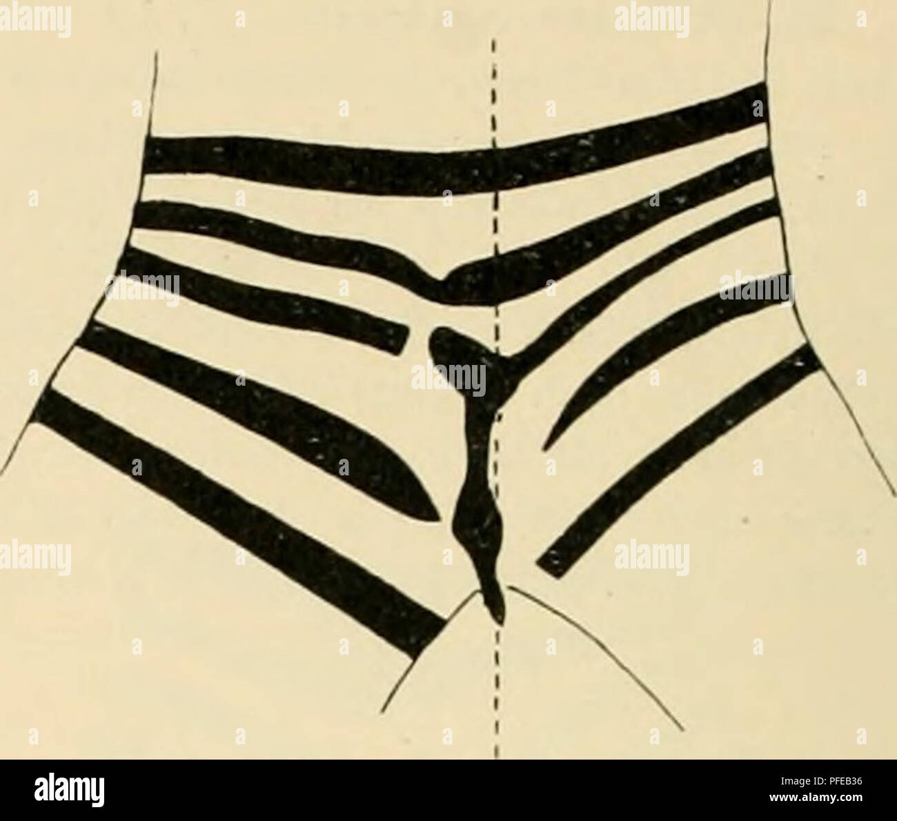 . Denkschriften der Kaiserlichen Akademie der Wissenschaften, Mathematisch-Naturwissenschaftliche Classe. 408 Richard Heller und Hermann v. SchrÃ¶tter,. 33. Trachea. (/. Â LÃ¤esn %divieto. Â Durchmesser der Trachea l'OMM, des rechten lironchus 16)Â"Â";, des linken Bronco 15/hh;. Der Anzahl Ringe 17. Der vorletzte a circuizione Mitte nach abwÃ¤gebogen rts; Gabelung hÃ¤ufig. Sporn erscheint bei der Daraufsicht mediana. Die rechte HÃ¤lfte des letzten Tracheairinges begibt sich in die Carina, um nach aufwÃ¤biegend rts in der Hinterwand spitz zu endigen. Das vordere Sporndreieck durch einen Fortsatz der r Foto Stock