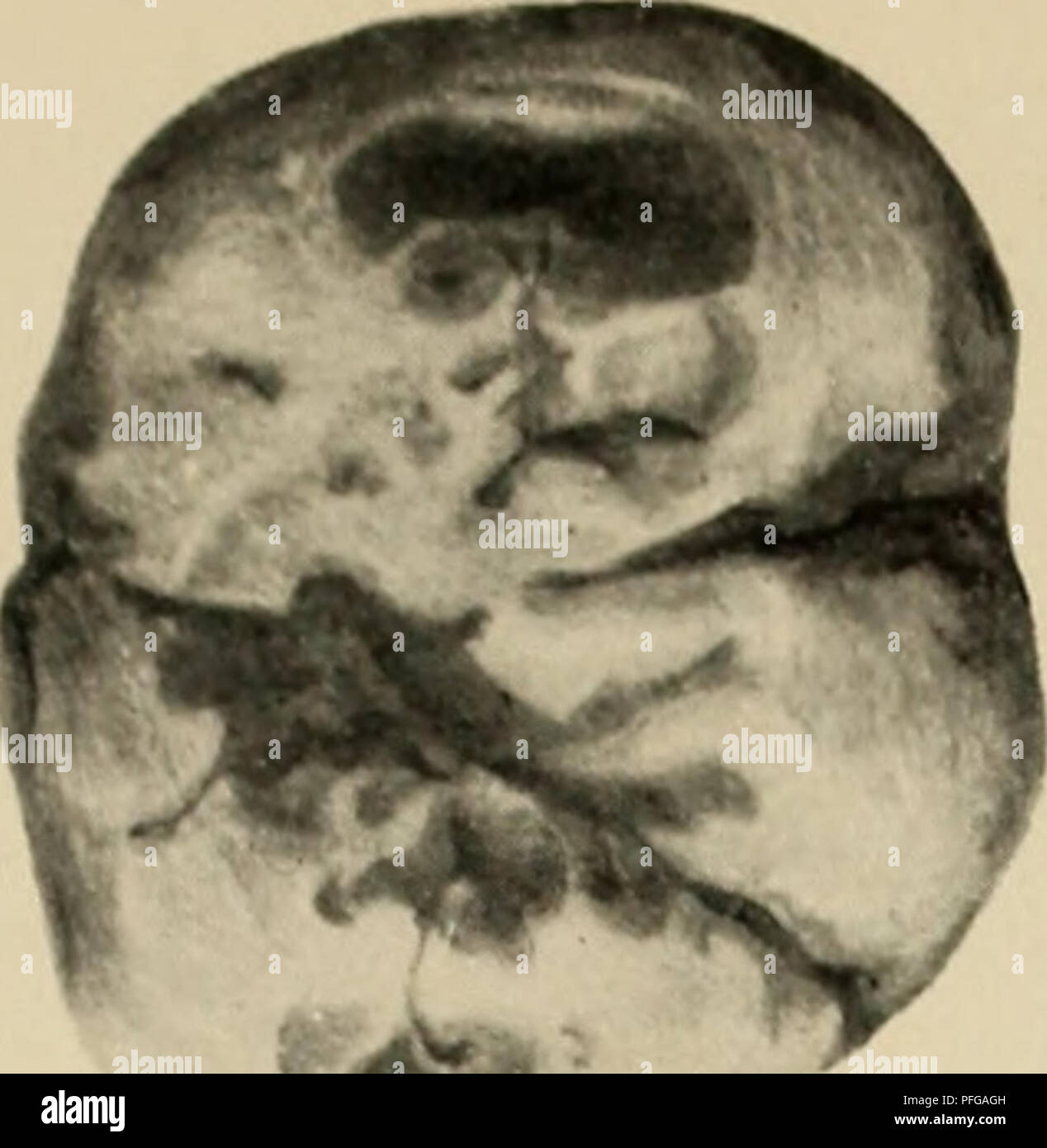 Questo lavoro mette a confronto l'anatomia dentale di esseri umani e primati, contribuendo alla nostra comprensione della storia evolutiva umana. L'illustrazione dettagliata si concentra sui denti di una specie umana e di una specie primata, offrendo una visione dell'anatomia comparata. Foto Stock