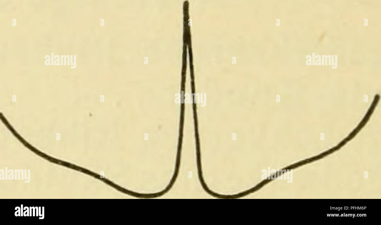 . Danmarks fauna, Biller. Coleotteri. Fig. 55. Vingedaekkernes Spids hos 1. Thanatophilus sinuatus $, 2. Th. dispar ?. tyndt, sorta behaarede, tydeligt ophøjede Pletter, iøvrigt graat behaaret. Vingedaekkerne med afrundede Skulder- vinkler, tappetino Ribbemellemrummene chagrinerede, fint og spredt punkterede, forsynede med blanke, flade Knuder; bagtil er Vingedaekkerne hos ^ afrundede, hos $ Søm er- spidsen yderst svagt udtrukket. Laengde 12-14 mm. (^: Per- og Mellem fødderne udvidede. Bagranden af Bagkroppens 7. Rygled omtrent lige afstudset (hos ? Tre- -per il sig. Buet). Skarevis ved Aadsler, almindelig. 3. Oeceoptom Foto Stock