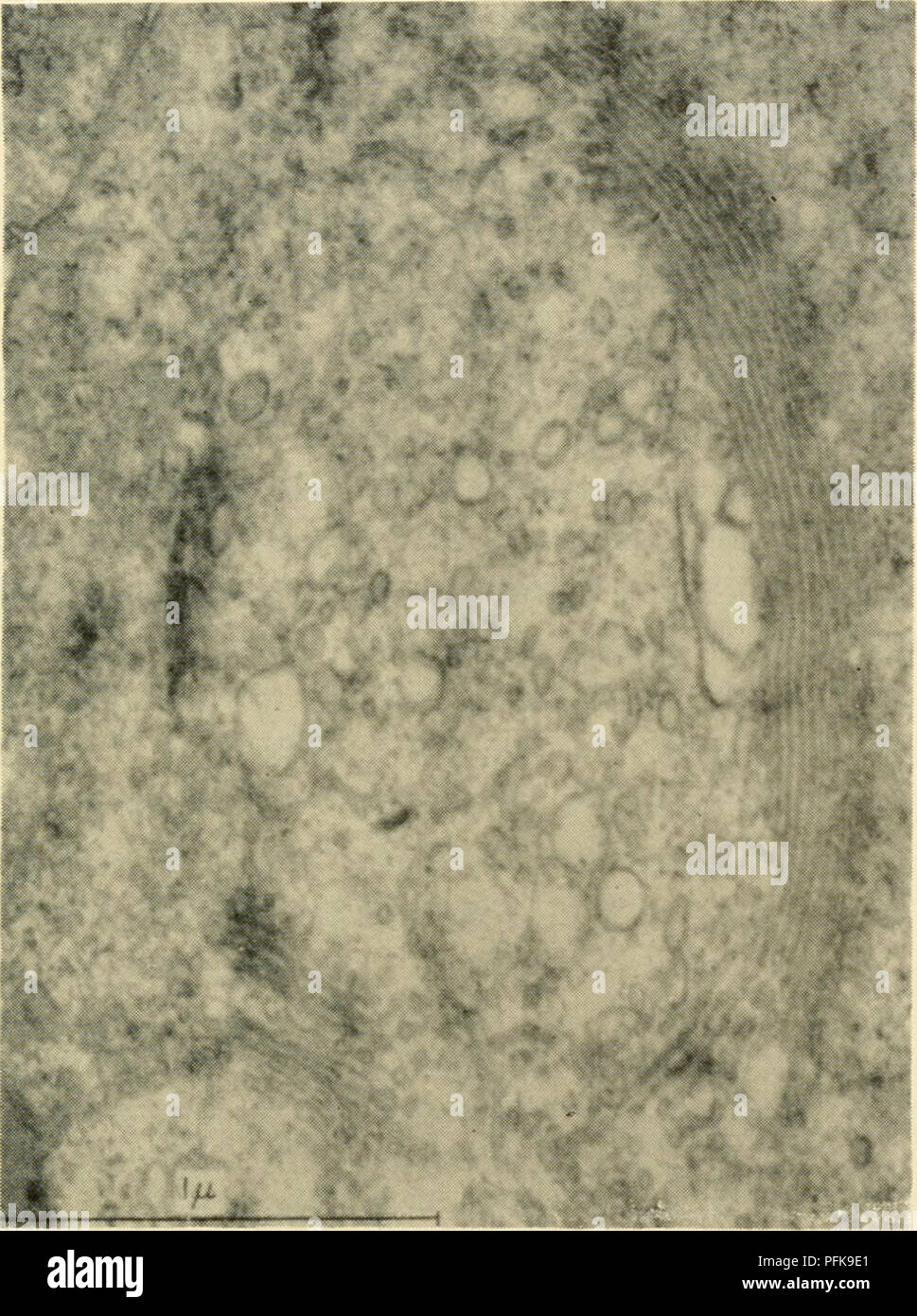 . La citologia. La citologia. brane elementi disposti in più o meno parallela moda (figure 3-30 e 3-31). Presentare le prove suggerisce che questo complesso è un organello separato del citoplasma e non una parte del reticolo endoplasmatico. A sostegno di tale punto di vista, i fatti seguenti possono essere citati: (1) Il modulo mem-. Figura 3-31. Micrografia elettronica del Complesso del Golgi in Sper primario- matocyte di giapponese Viviparid lumaca, Vivipariis. Il complesso del Golgi appare come un array di parallelo liscio membrane che racchiude una serie di legati a membrana vescicole di dimensione variabile. (Da PoUister, A. W. e Pol- liste Foto Stock