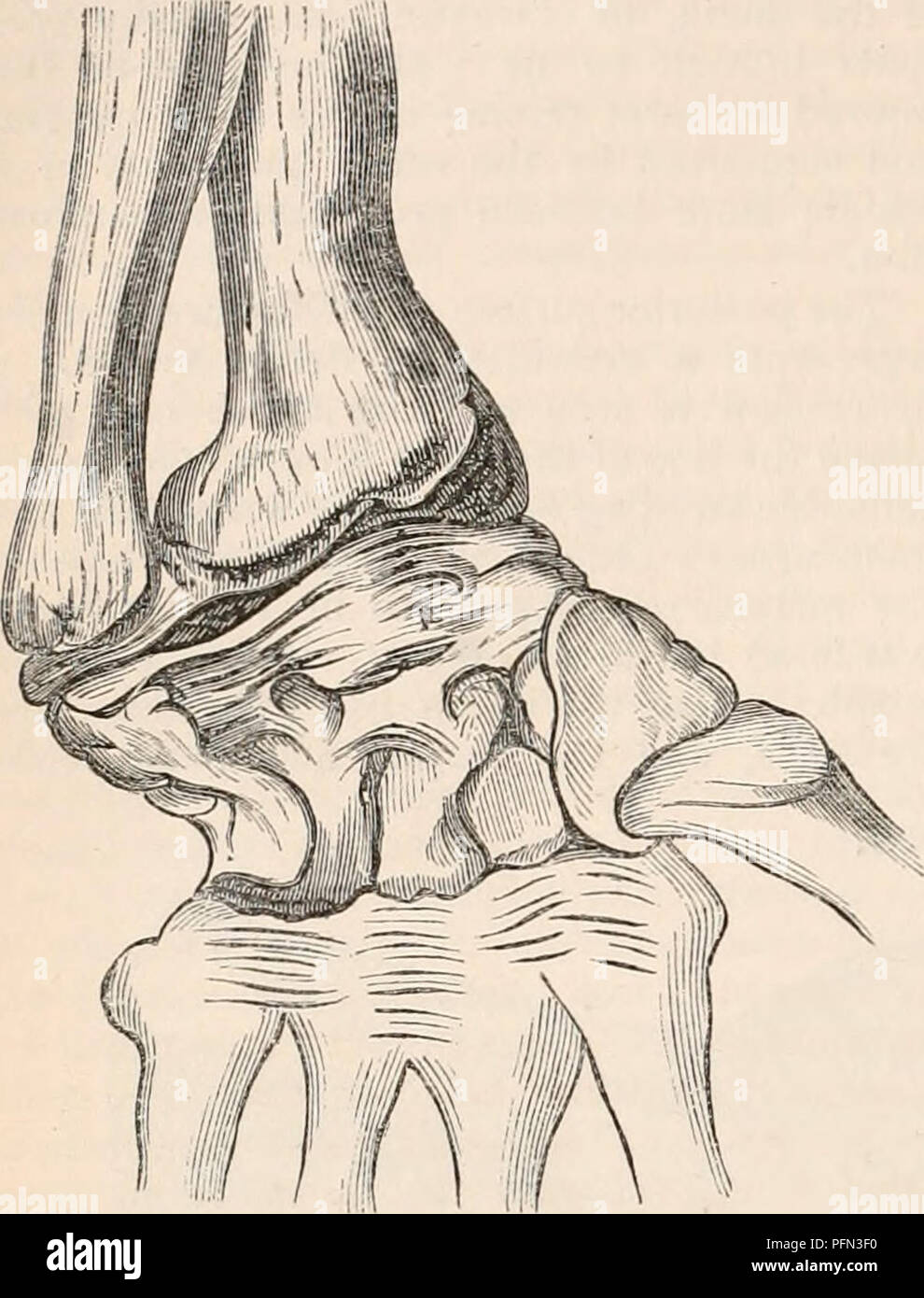 . Il encyclopaedia - Wikizionario di anatomia e fisiologia. Anatomia e fisiologia; Zoologia. 1518 polso sferico (Anatomia anormale). prendere posto in corrispondenza di un punto che è al di sotto del livello Cooper, che afferma che in questo una frattura di questa linea e qualsiasi spostamento, il risultato molto potente estensione è necessaria per portare di frattura, possono facilmente influenzare la larghezza della estremità rotte del raggio in apposizione del interosseous spazio, poste al di sopra della linea di frattura. Fig. 932. Ftg. 931.. È solo nel caso in cui la frattura si trova così in alto come un pollice e mezzo, o più, al di sopra del giunto, che ogni anomalo Foto Stock