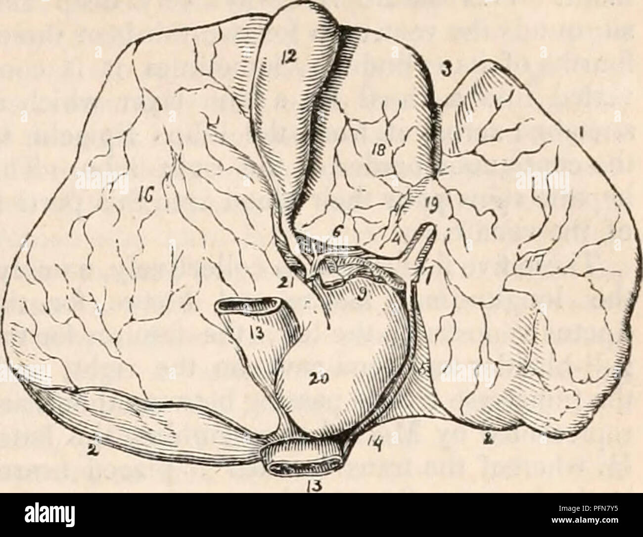 . Il encyclopaedia - Wikizionario di anatomia e fisiologia. Anatomia e fisiologia; Zoologia. Anatomia normale del fegato. 161 (triangolare) sono due pieghe triangolare di peri- toneum che inizia in corrispondenza di ciascuna estremità del bordo posteriore del fegato e convergono verso la terminazione degli indirizzi di massima di legamento. Essi sono di vasta portata in prossimità delle estremità dell'o- gan, e permettono un certo grado di movimento a destra e a sinistra dei lobi, ma diventano strette quando si avvicinano alla linea mediana. I due strati che compongono il diritto legamento laterale separata poiché essi passano verso l'interno, e parzialmente inclose uno spazio ovale (11, 11) del Var Foto Stock